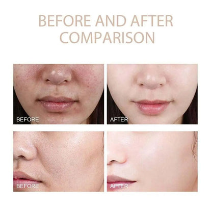 Moisturizing Rice Exfoliating Essence Hydrating Oil