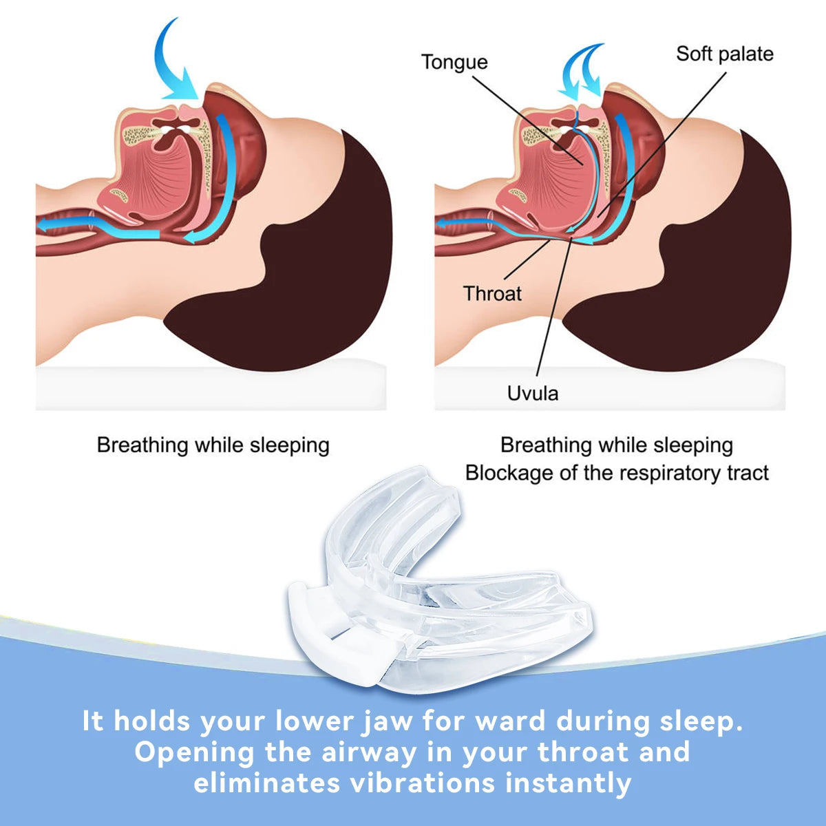 Adjustable Anti Snoring Mouthpiece